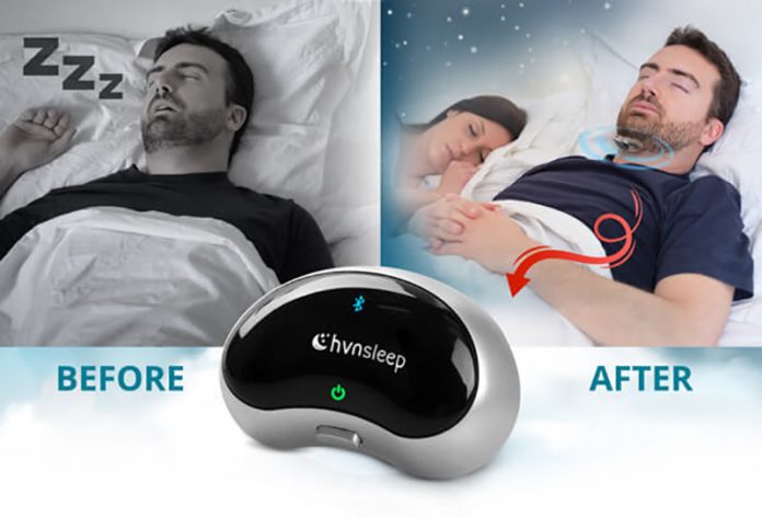 Anti-snoring Device