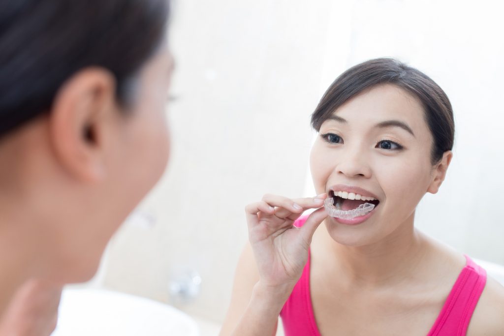 The Growing Popularity of The Clear Aligner Industry In America - The ...