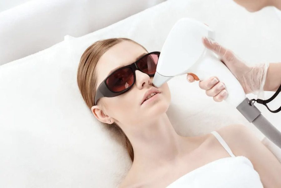 Laser Hair Removal