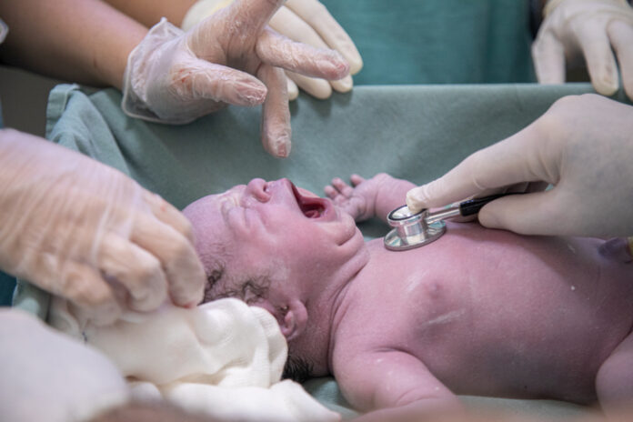 Newborn being examined by doctor using stethoscope